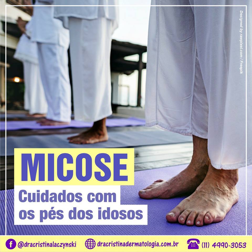 Micose - SBD